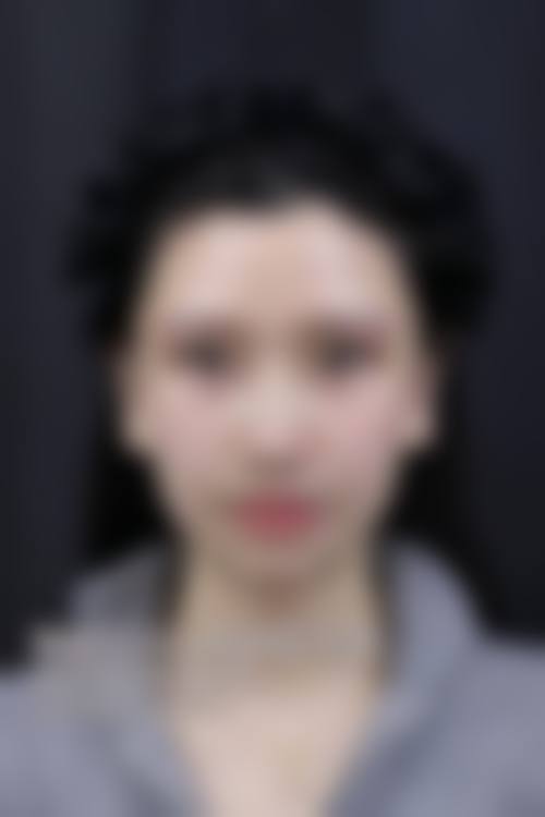 二、顺德容桂贝尔美医疗美容专科医院怎么样?