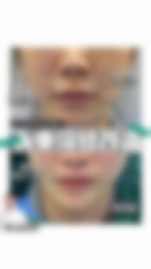 八、成都easySCULPT怡脂整形预约方式