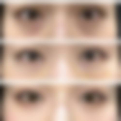 九、成都瑞美荟医疗美容医院真实的患者评价