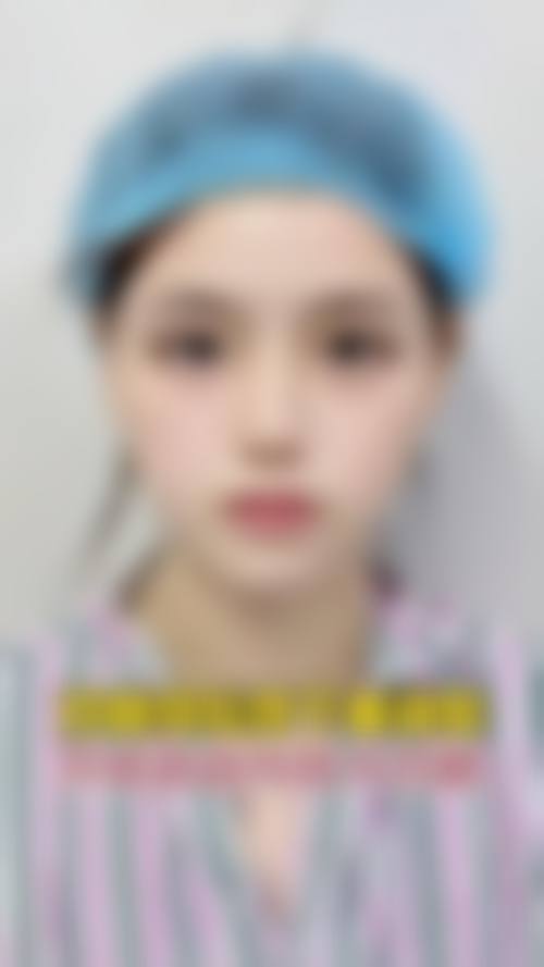 八、邛崃星宸医学美容诊所真实的患者评价