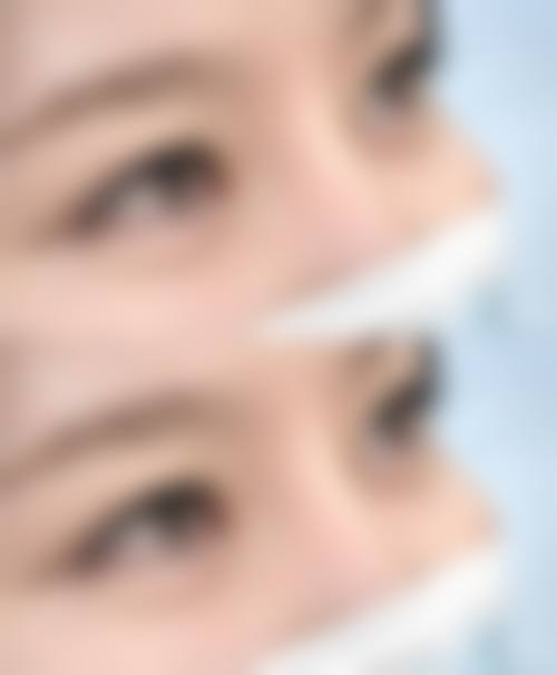 七、榆林亿安医院医学美容整形科预约方式