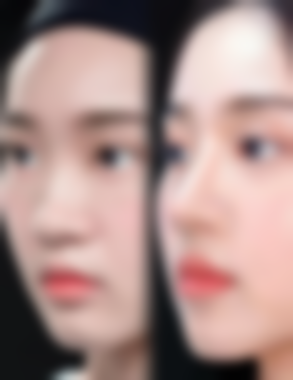 三、成都easySCULPT怡脂整形诊疗项目有哪些?