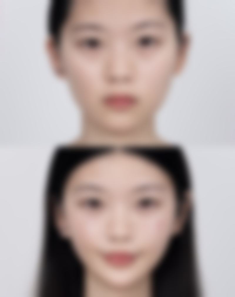 一、纯牛奶去眼袋的成效分析