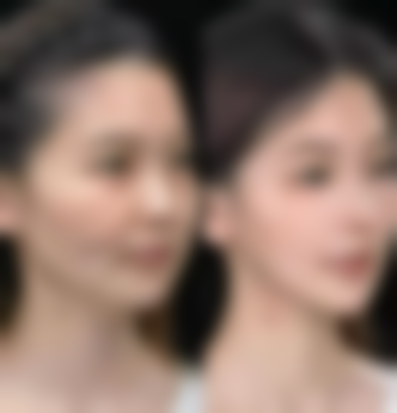 六、顺德容桂贝尔美医疗美容专科医院价格表