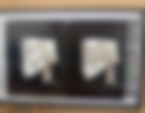 六、去眼袋的风险提示