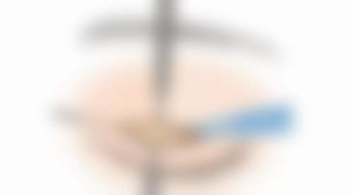 四、徐州星晨妇儿医院医疗美容科特色项目