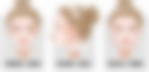 一、眼袋肌肉松弛的原因