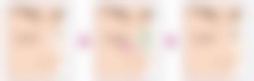 五、日常护理建议