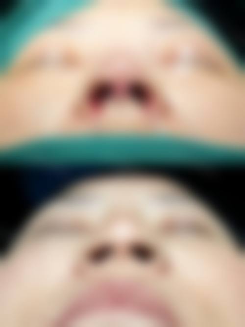 四、台州薇凯医疗美容门诊部特色项目