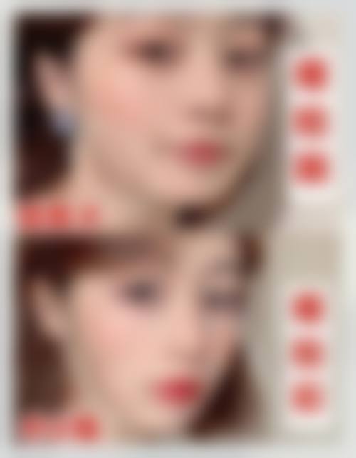 九、解放军第990医院整形美容外科（原159医院）真实的患者评价