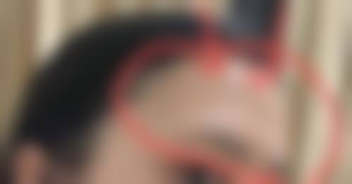 八、解放军第990医院整形美容外科（原159医院）预约方式