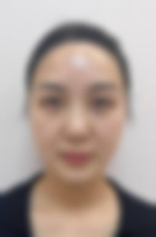 五、台州薇凯医疗美容门诊部价格表