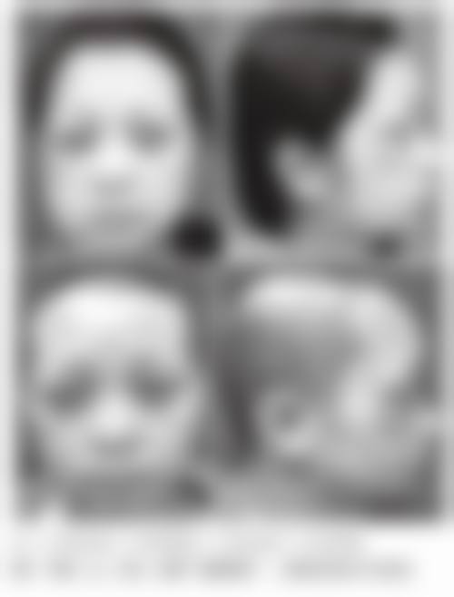 四、上海博爱医院特色项目