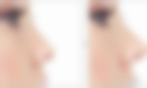 二、温州协和医院整形美容科怎么样？