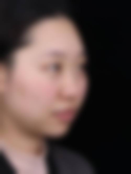 九、西安雁塔周安医疗美容整形医院真实的患者评价