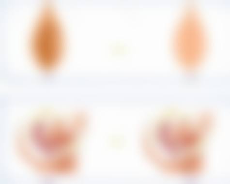 四、台州星派医疗美容门诊部特色项目