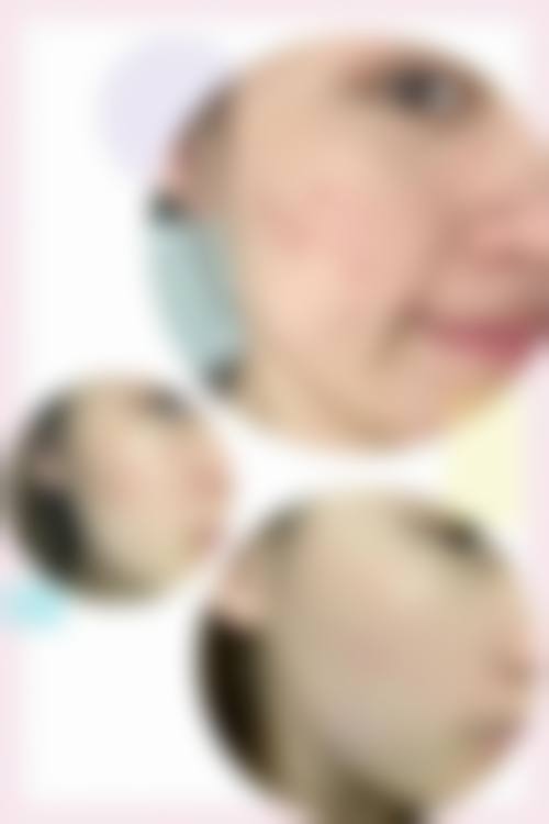 九、柳州华 山医院真实的患者评价