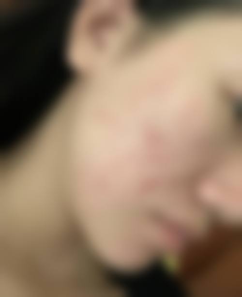 二、台州星派医疗美容门诊部怎么样?