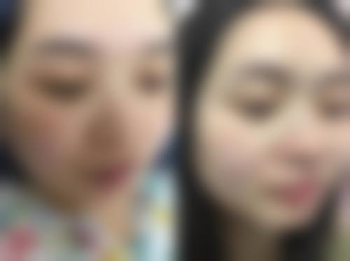 二、潜江薇格整形医院怎么样？