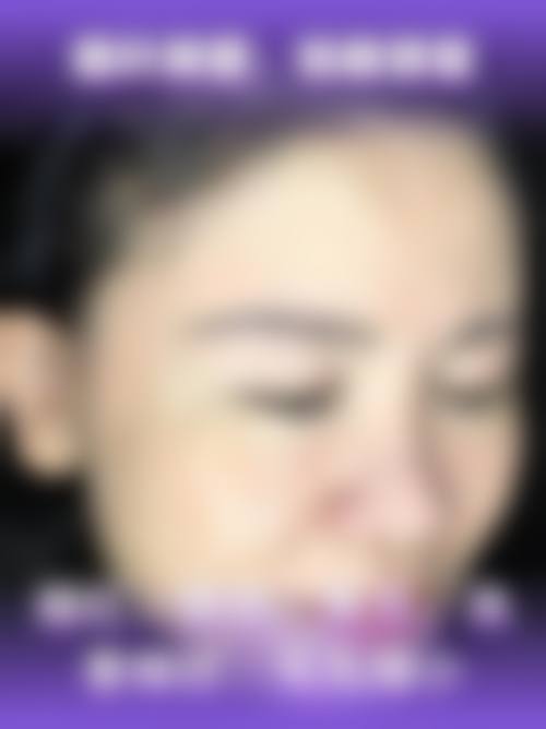 八、国内医学科学 院北京协和医院(整形美容外科)真实的患者评价