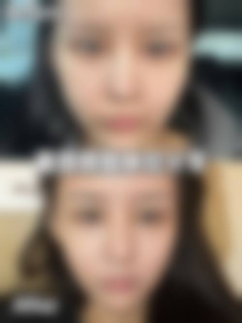 九、简阳卡秀整形医院真实的患者评价