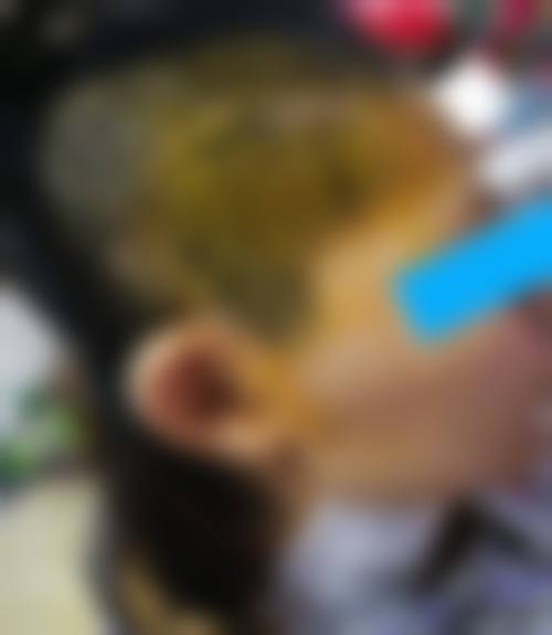 七、台州星派医疗美容门诊部预约方式