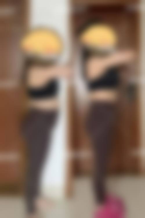 八、李周赫KIESU整形外科医院真实的患者评价