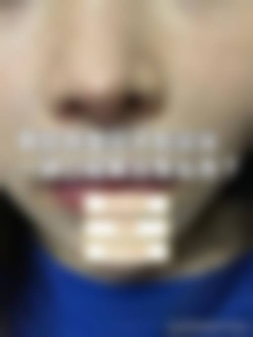 四、万宁韩秀尚意整形医院特色项目