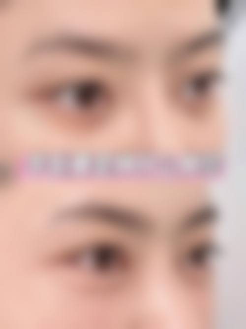 八、北京四惠中医医院医疗美容科真实的患者评价