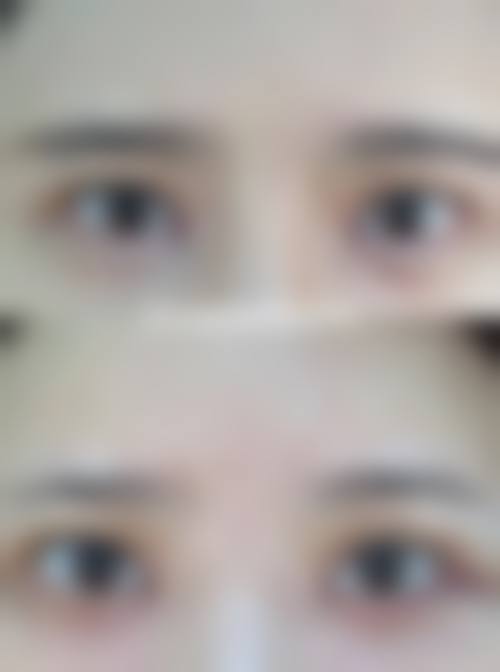 三、北京四惠中医医院医疗美容科诊疗项目有哪些？