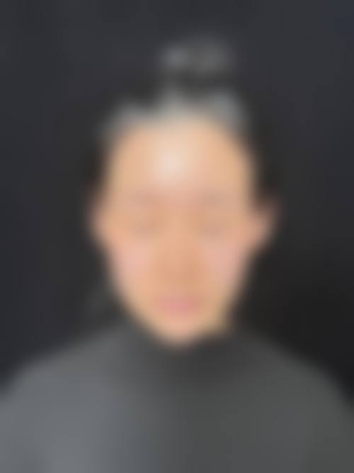 二、西安雁塔周安医疗美容整形医院怎么样？