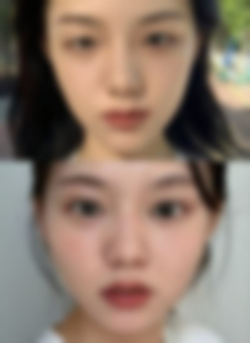 四、李周赫KIESU整形外科医院特色项目