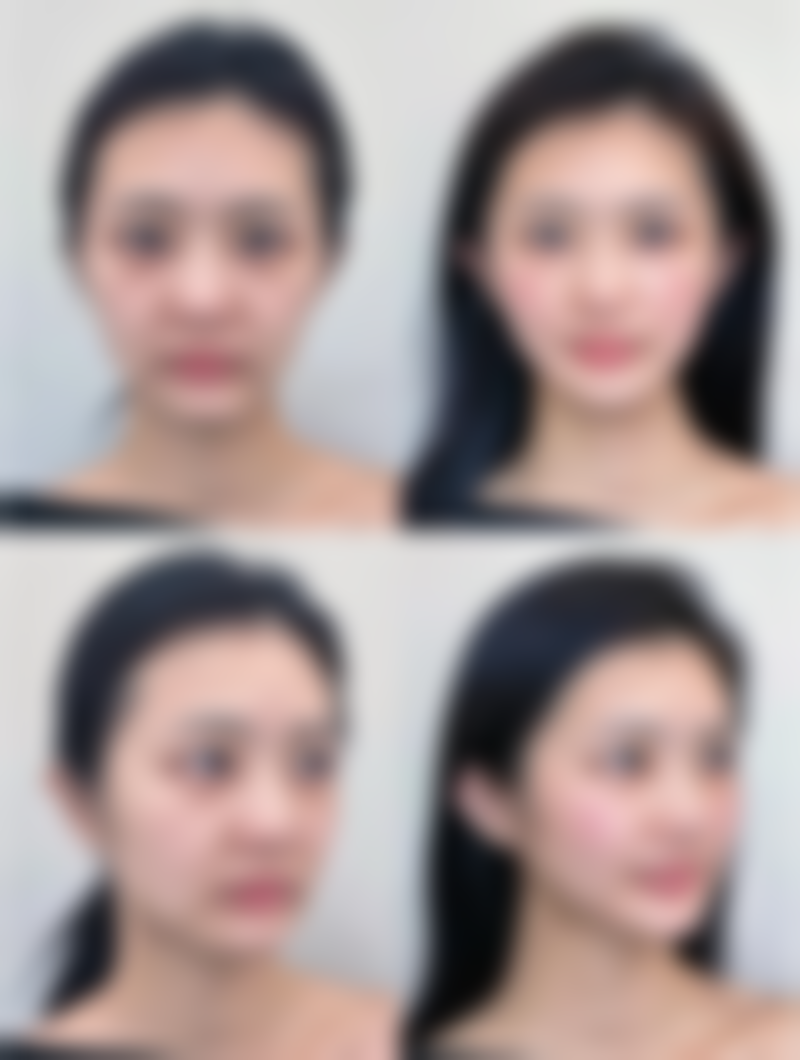 眼袋肌肉松弛怎么办？掌握这些方法助你快速恢复紧致双眸！ 