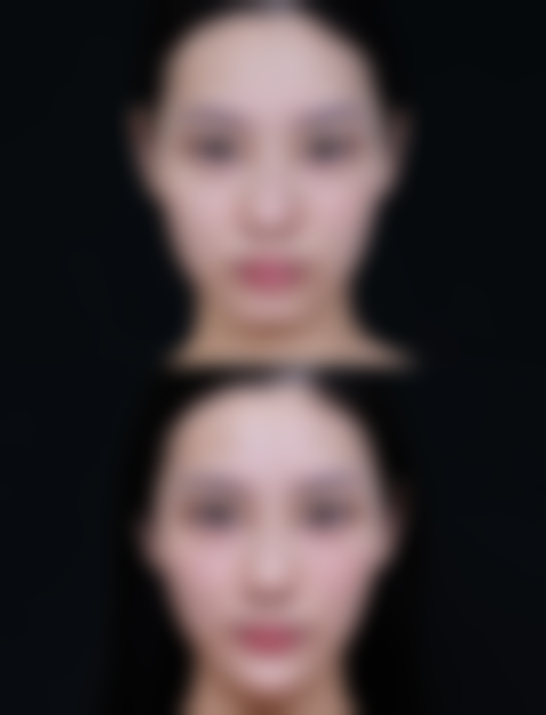 九、万宁韩秀尚意整形医院真实的患者评价