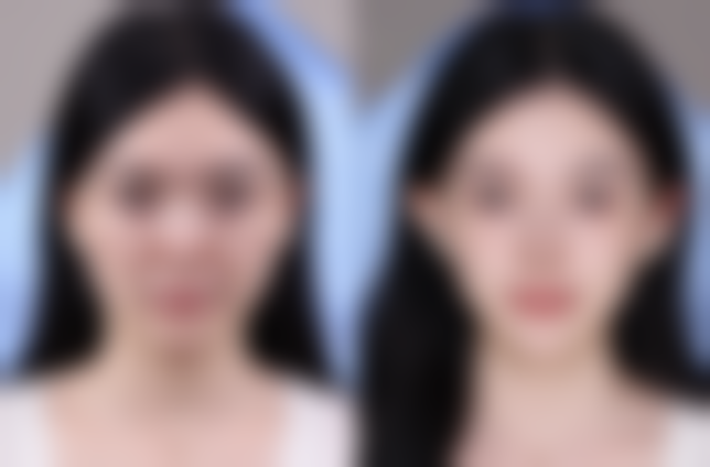 四、韩国21整形外科特色项目