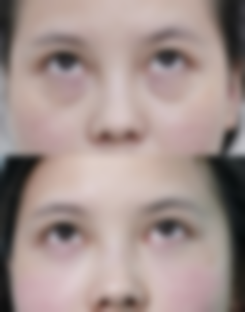 三、台州薇凯医疗美容门诊部诊疗项目有哪些？