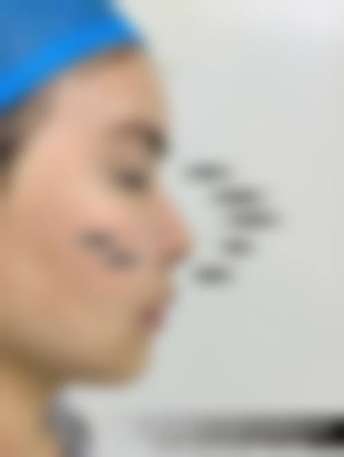 七、韩国延世eyes整形外科预约方式