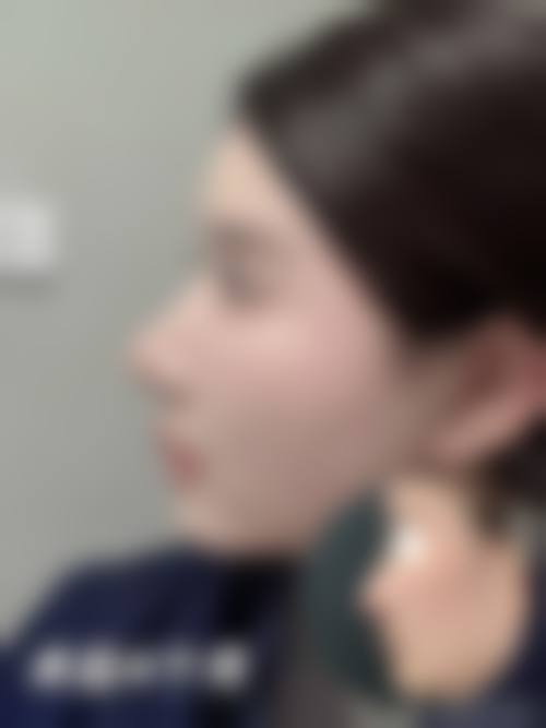 二、长沙荪臻臻整形医院怎么样？