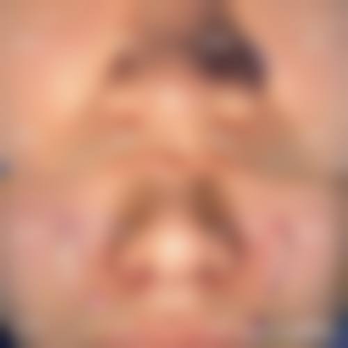 七、佛山幼肤医学美容预约方式