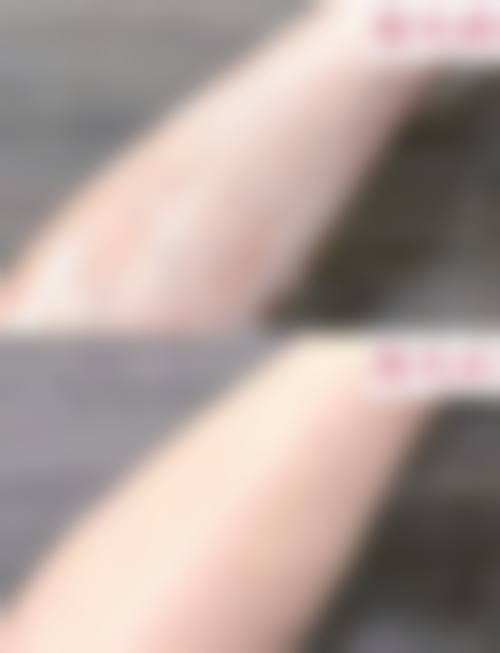 四、福州麦瑞医疗美容诊所特色项目