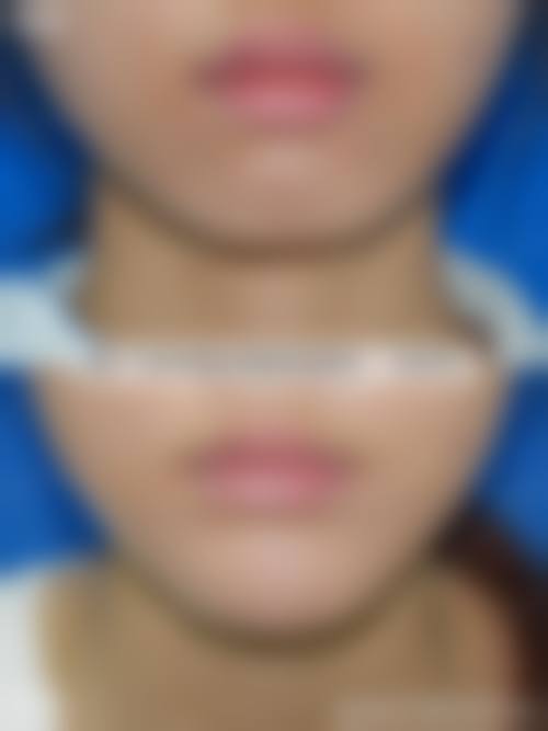 五、济南市中宝丽美容整形诊所价格表