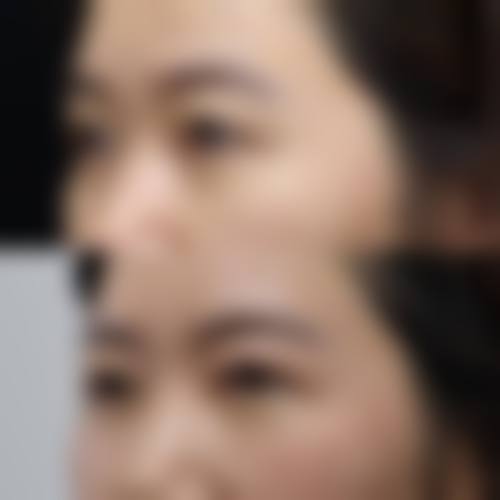 三、佛山幼肤医学美容诊疗项目有哪些？