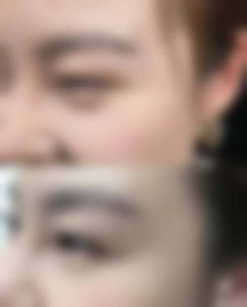 四、楚雄吴氏嘉美整形医疗美容特色项目