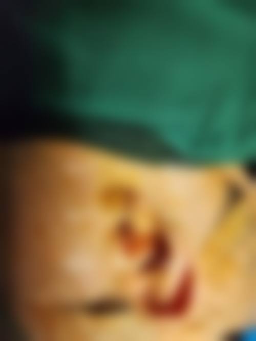 二、怀化市第二人民医院整形美容科怎么样？