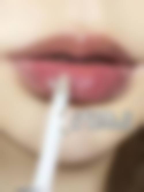 三、长沙荪臻臻整形医院诊疗项目有哪些？