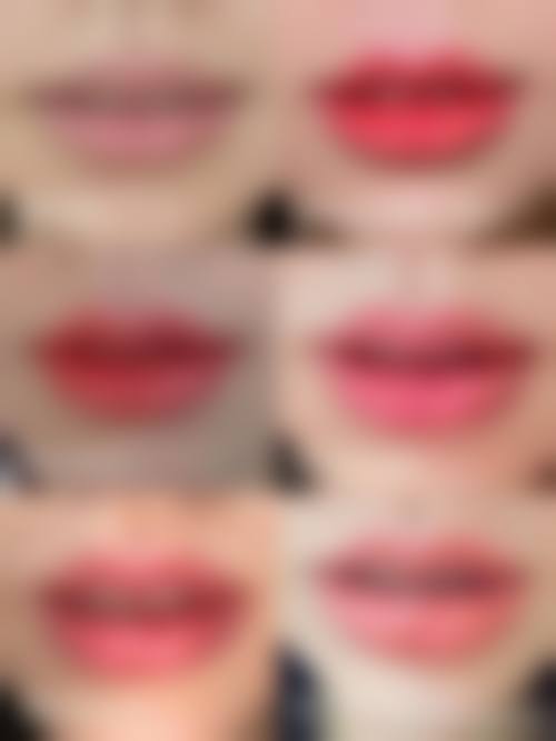 六、长沙荪臻臻整形医院价格表