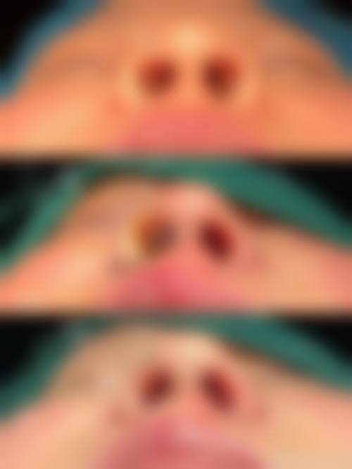 二、佛山幼肤医学美容怎么样？