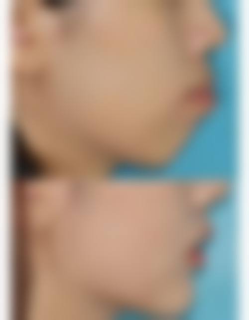 三、韩国延世eyes整形外科诊疗项目有哪些？