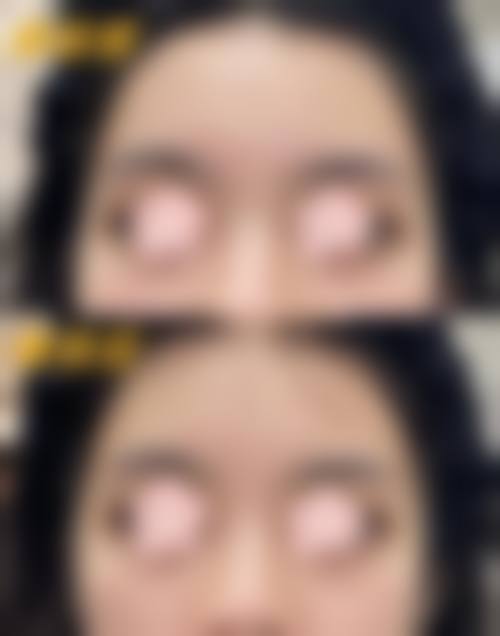 九、昆明医梵整形医院真实的患者评价