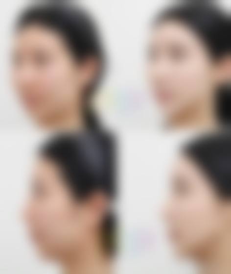 四、怀化市第二人民医院整形美容科特色项目